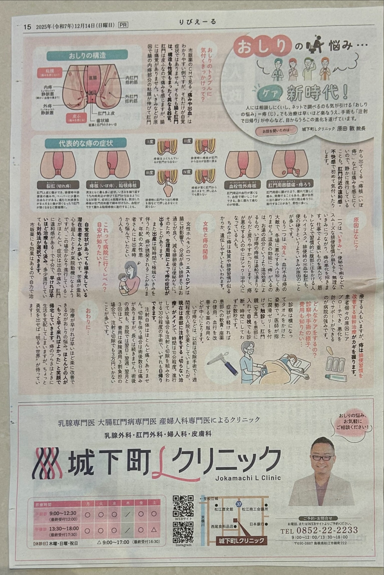 肛門】島根で痔の日帰り手術なら1年間167例の実績と「りびえーる」掲載